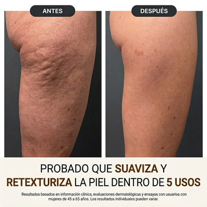 NovaPure ® - Aceite corporal de seda / Redescubre la confianza con una piel más firme, suave y radiante