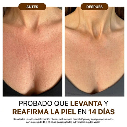 NovaPure ® - Aceite corporal de seda / Redescubre la confianza con una piel más firme, suave y radiante