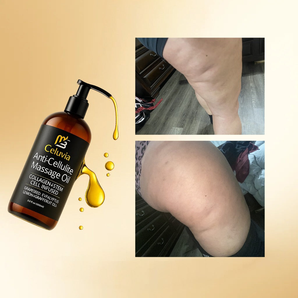 Colágeno Corporal – Serum anticelulitis y tonificante de rápida absorción