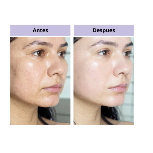 Botox en crema - El Secreto de las Modelos Latinas / Para una Piel Lisa, Firme y sin Poros PRO