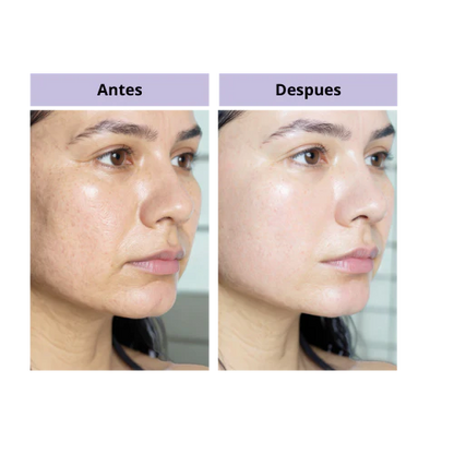 Botox en crema - El Secreto de las Modelos Latinas / Para una Piel Lisa, Firme y sin Poros PRO