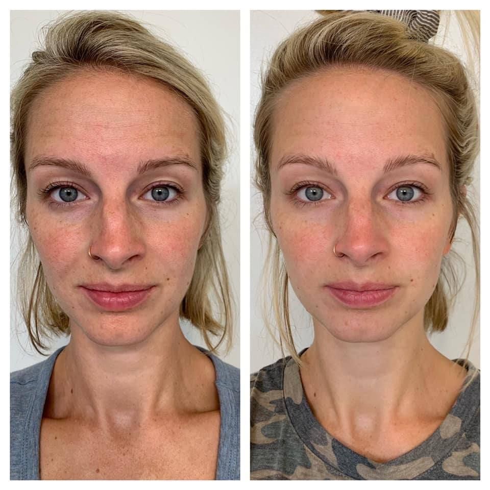 JIYU - Crema rejuvenecedora con ácido HIALURÓNICO de alta concentración / hidrata profundamente y mantiene tu piel perfecta todo el día