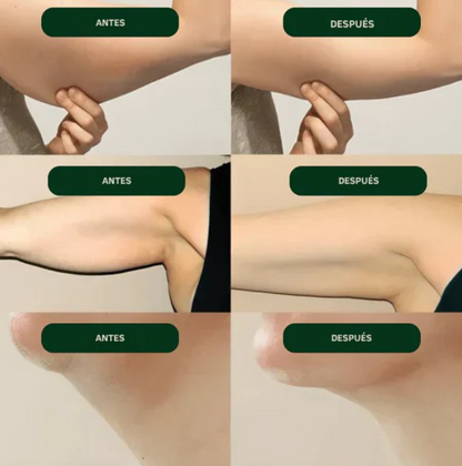 BODY FLOW – Menos inflamación, más ligereza