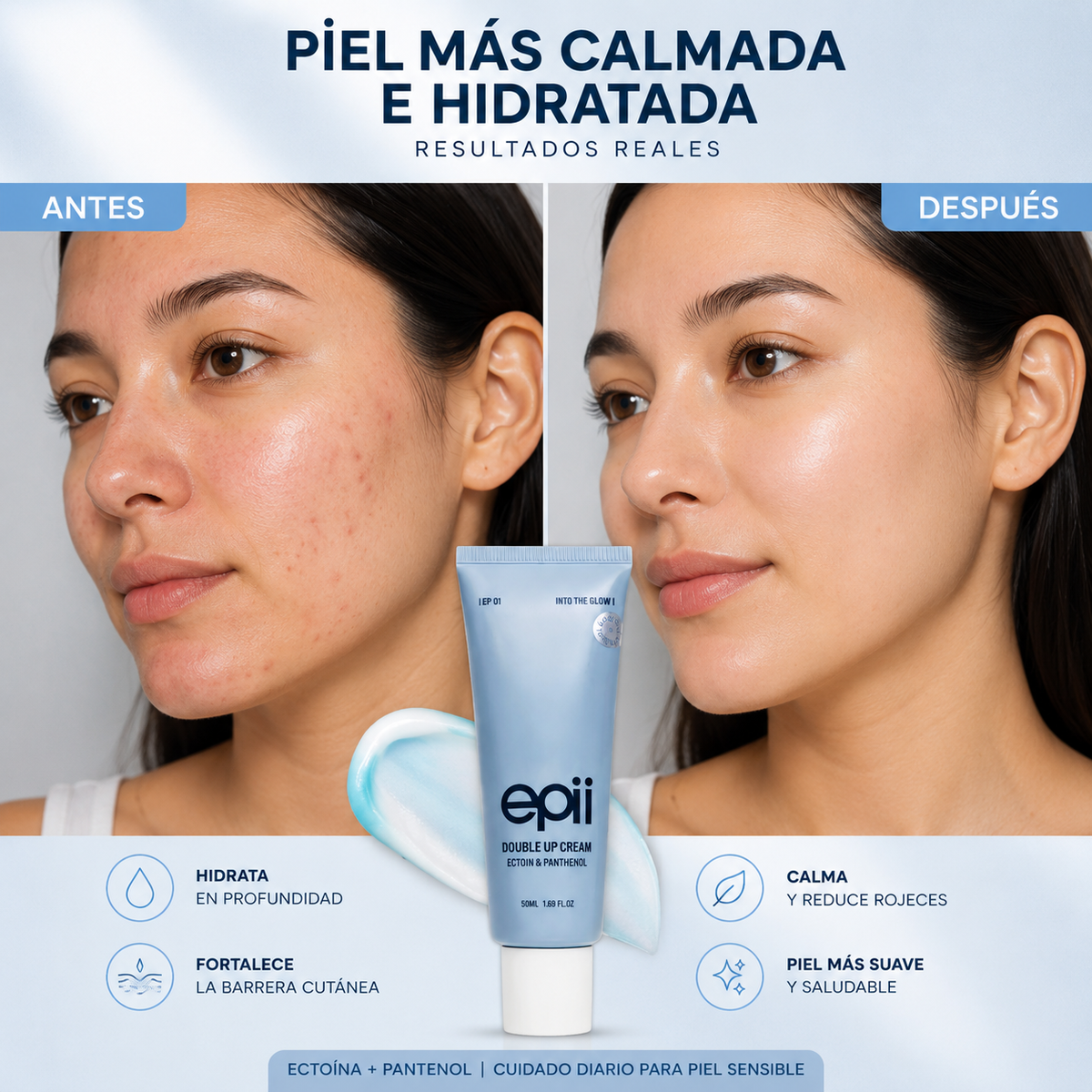 Epii - Crema de Doble Acción con Ectoína y Pantenol / Cuidado intensivo para tu piel