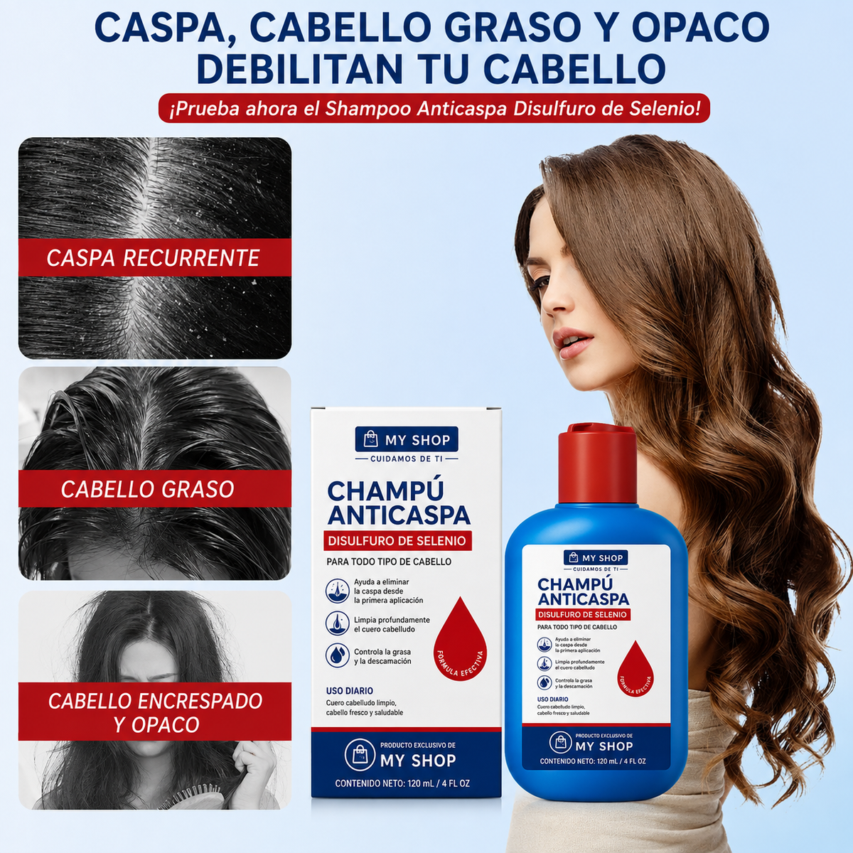CHAMPÚ ANTICASPA - Despidete de la caspa y el cabello grasoso en 10 días