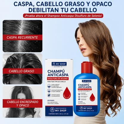 CHAMPÚ ANTICASPA - Despidete de la caspa y el cabello grasoso en 10 días