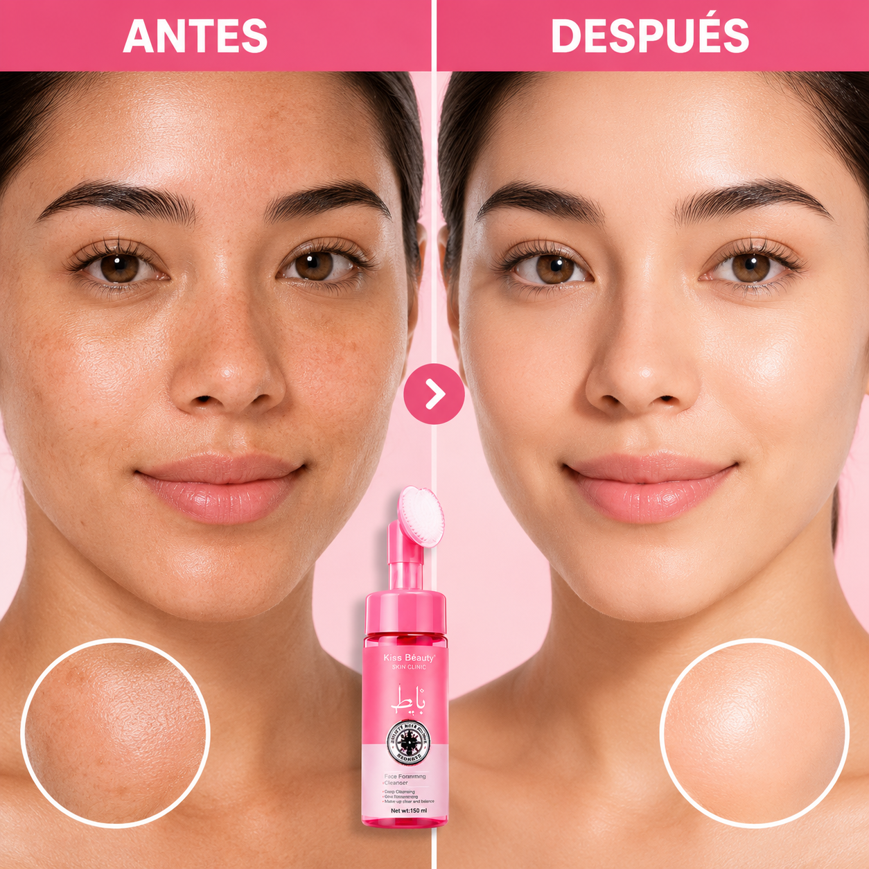 LIMPIADOR FACIAL KISS BEAUTY