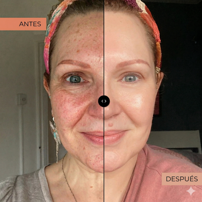 MULTI COLLAGEN – Péptidos bioactivos que elimina arrugas y manchas al instante y dolores articulares