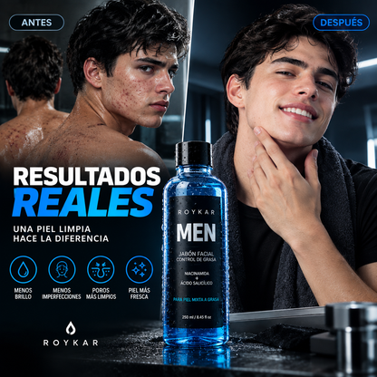 ROYKAR MEN - Jabon que elimina las imperfecciones del rostro