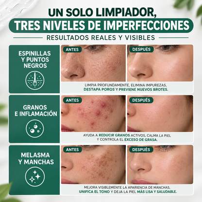 MELAMAX - Limpiador Facial anti-imperfecciones