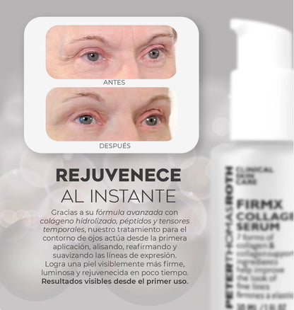 TENSOR FACIL - Rejuvenece Naturalmente
