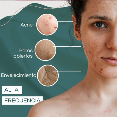 Cleanance Avène - el sérum que elimina el acné, reduce marcas y mejora la textura de tu piel