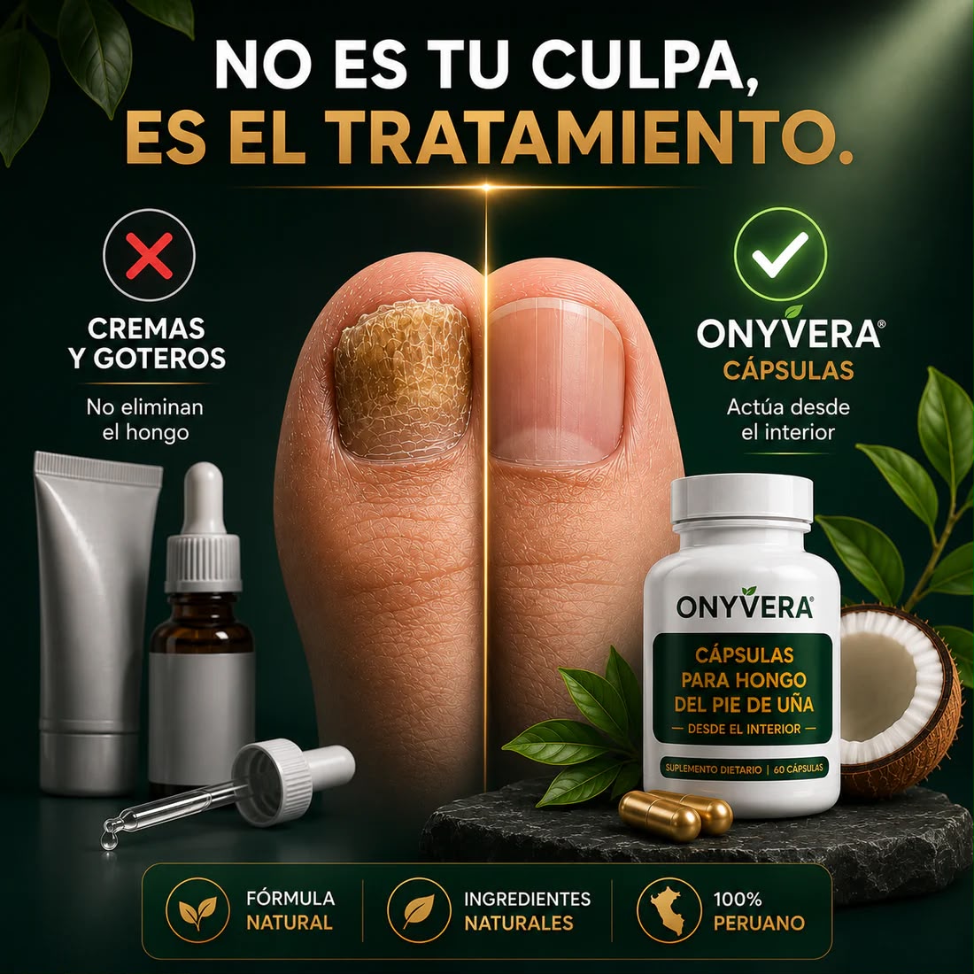 ONYVERA - CÁPSULAS PARA LOS HONGOS