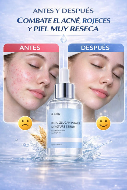 SERUM BETA™ ⭐⭐⭐⭐⭐ ELIMINA ACNE - MANCHAS - PIEL ROJA Y RESECA